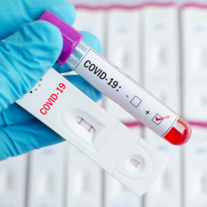 Pannello anti SARS COV 2 (Covid19) IgG- IgM