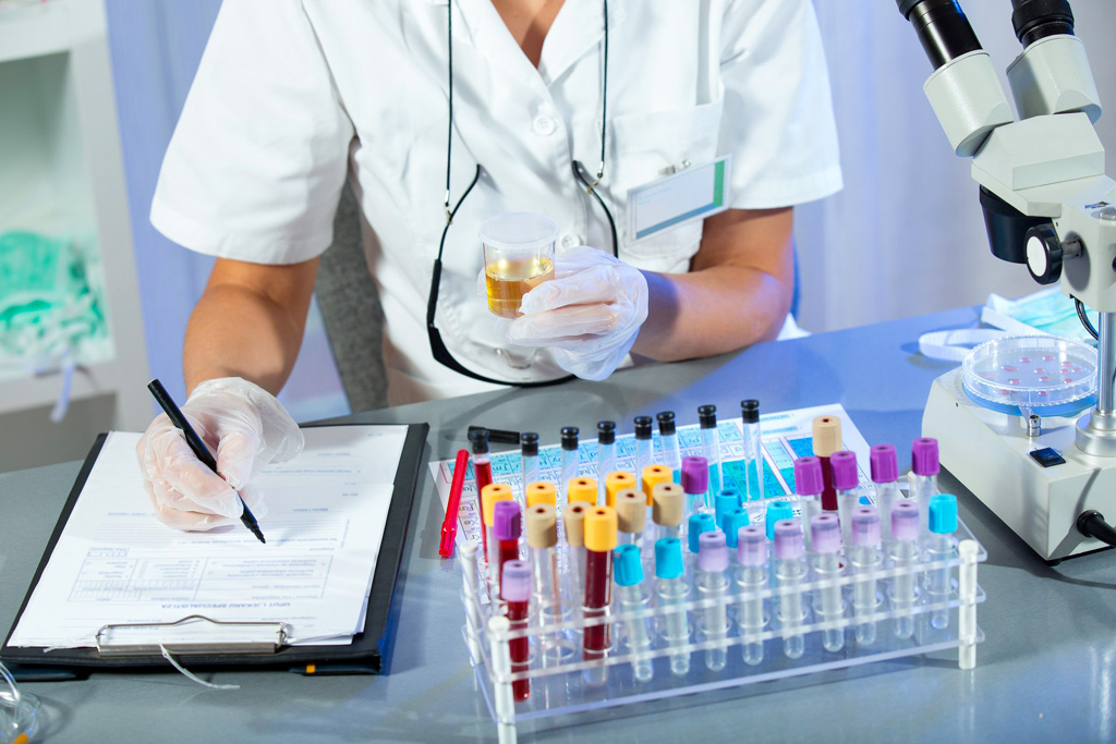 Esame microalbuminuria
