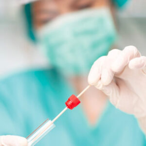 Tampone molecolare (PCR) per la ricerca RNA SARS-Cov-2